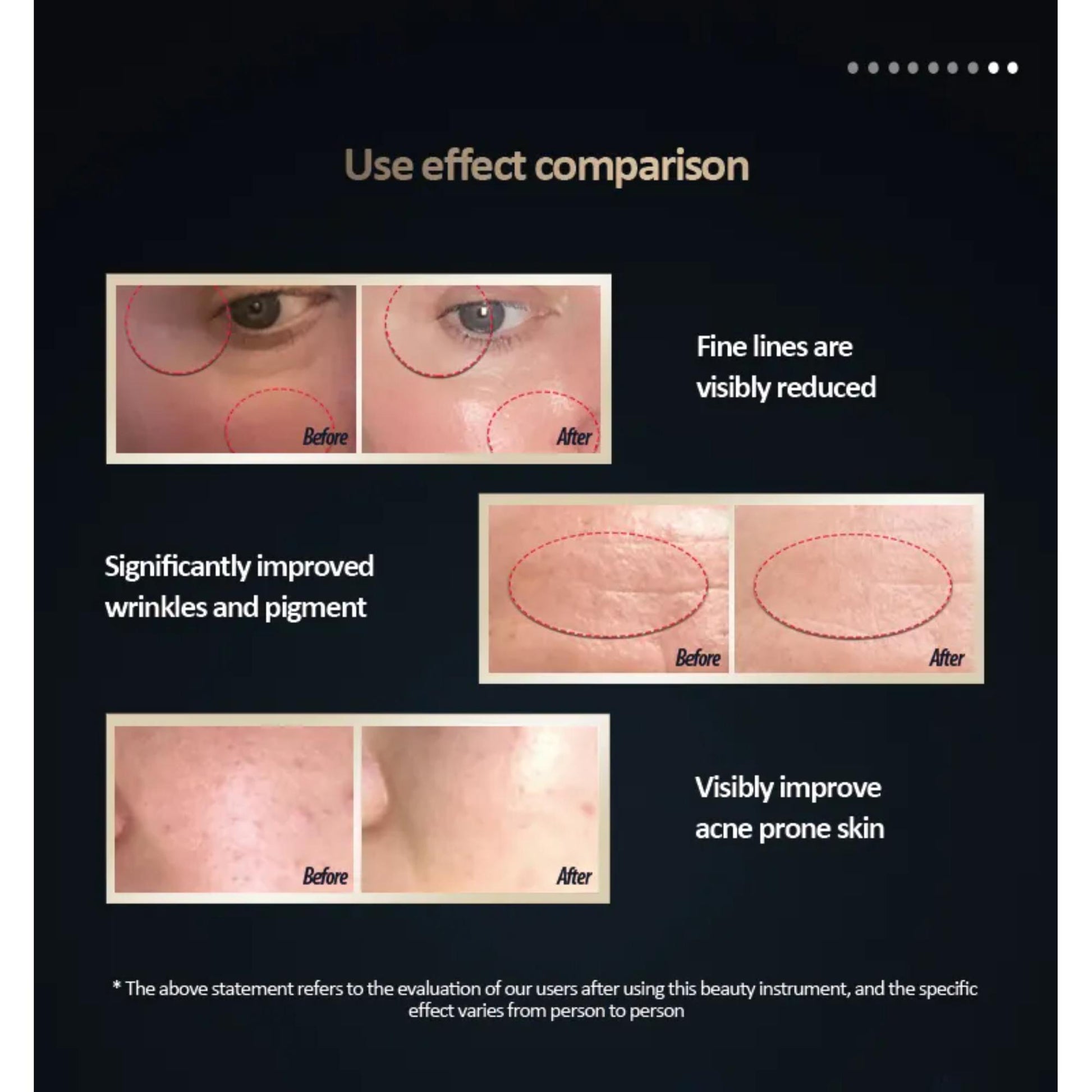 Smooth, Youthful Skin: Jiumei HQ-B005 Anti-Wrinkle Beauty Device. | Blue Chilli Electronics.