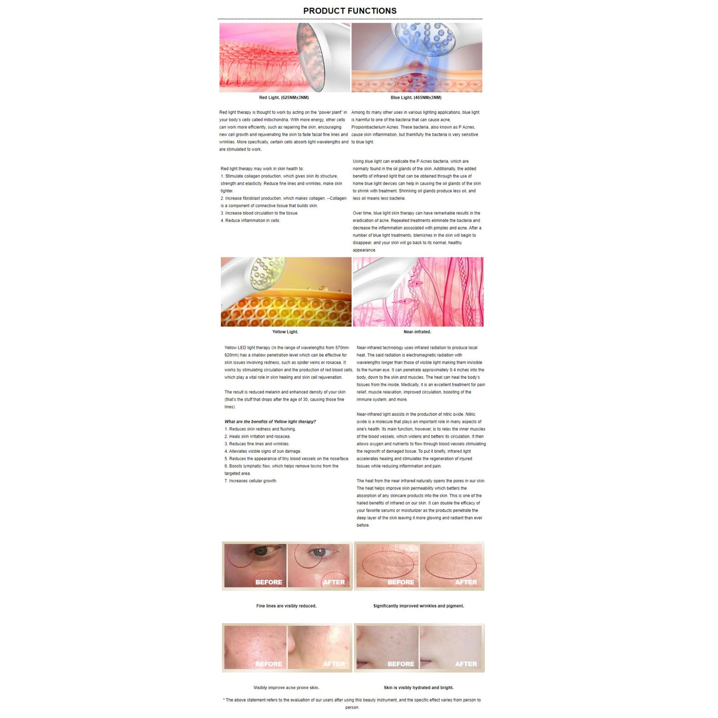 Jiumei HQ-B005 Portable Electric Anti-Wrinkle Device: Skin Rejuvenation Beauty Tool.| Blue Chilli Electronics.